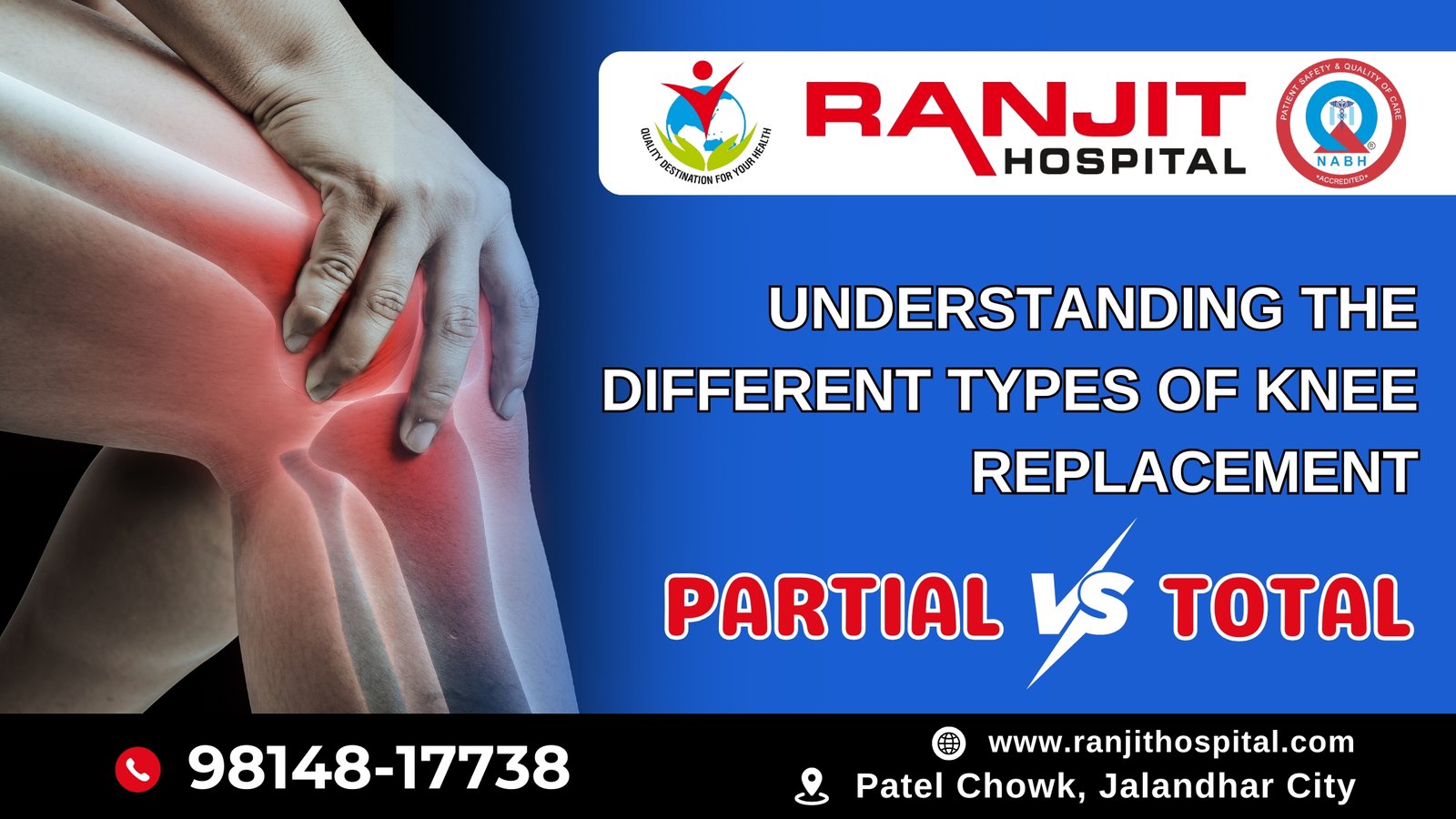 Understanding the Different Types of Knee Replacement: Partial vs. Total